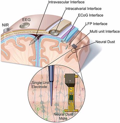 Defining Surgical Terminology and Risk for Brain Computer Interface Technologies